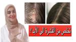 أسباب وعلاج قشرة فروة الرأس