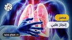 إنجاز طبي: زراعة رئة خنزير في إنسان