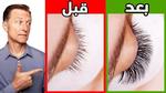 تساقط الرموش: الأسباب والحلول
