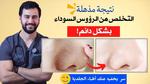 سنفرة البشرة: سر جمالك الدائم