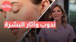طرق فعالة لترطيب البشرة وتفتيحها