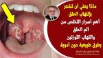 علاج التهاب الحلق بطرق طبيعية فعالة