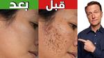 كيفية التخلص من البقع الداكنة على البشرة