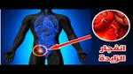 مخاطر انفجار الزائدة الدودية عند الأطفال