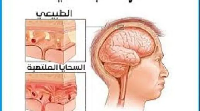 فوائد العدس الأصفر، يقوي المناعة ويحارب السرطان