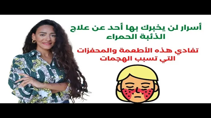 أعراض وطرق علاج الذئبة الحمراء