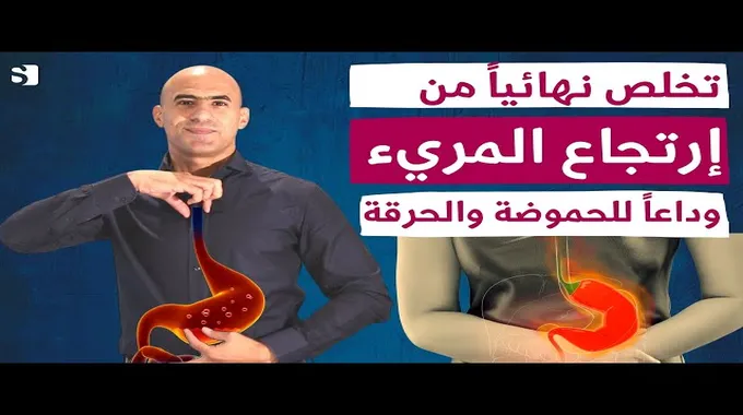أعراض وعلاج ارتجاع المريء بطرق طبيعية