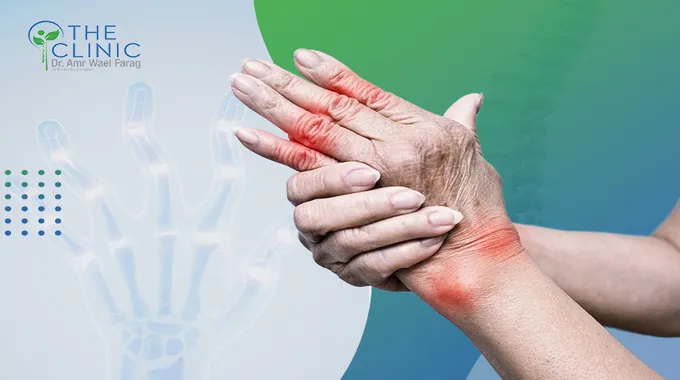 التهاب المفاصل الروماتويدي: الأسباب والأعراض