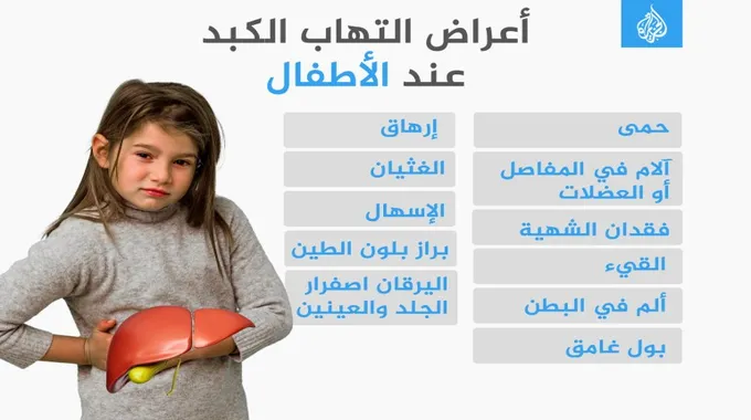 اليرقان عند الأطفال: الأسباب والعلاج