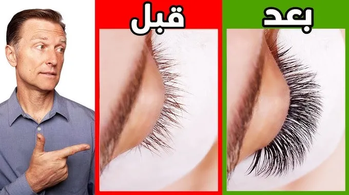 تساقط الرموش: الأسباب والحلول