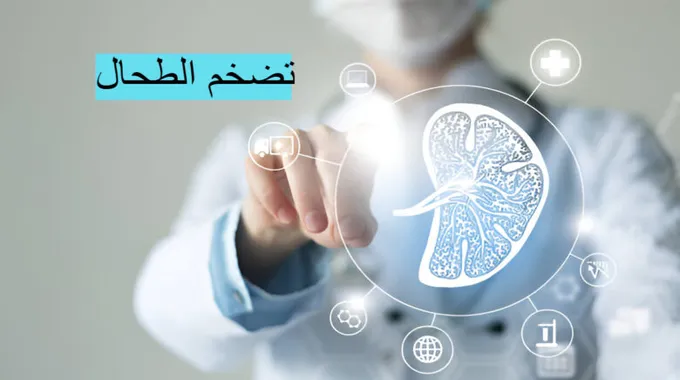 تضخم الطحال: الأسباب والأعراض والعلاج