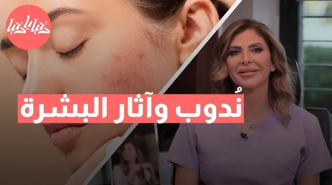 طرق فعالة لترطيب البشرة وتفتيحها