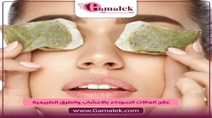 علاج الهالات السوداء بطرق طبيعية فعالة