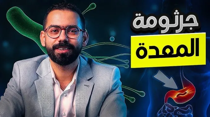 علاج جرثومة المعدة وأعراضها وطرق الوقاية