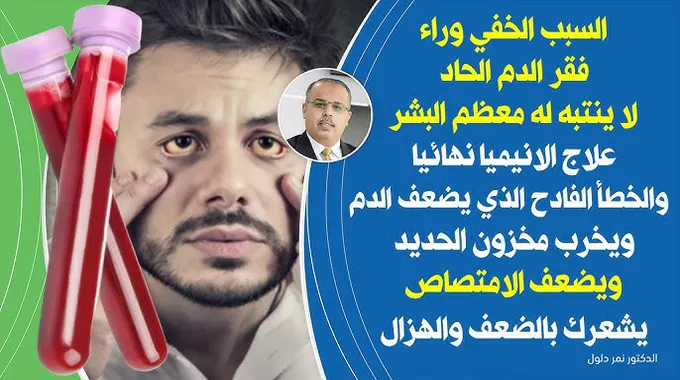 فقر الدم عند الأطفال: الأسباب والعلاج