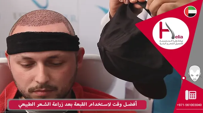 كيفية تجنب الندبات على البشرة بطرق بسيطة