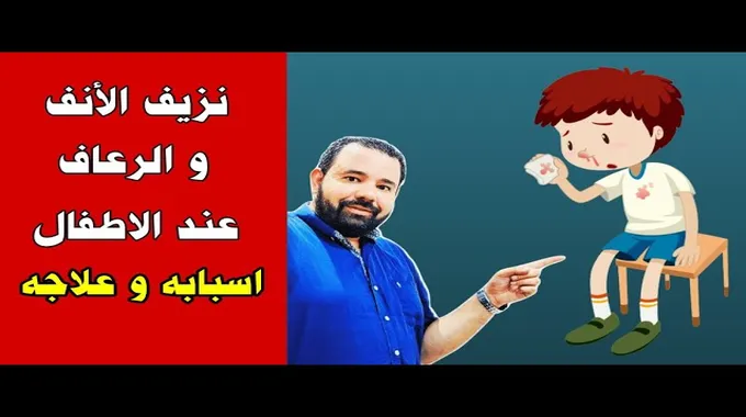 نزيف الأنف عند الأطفال وأسبابه وطرق العلاج