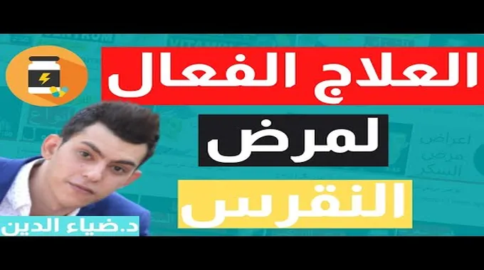 نوبة النقرس: الأعراض والعلاج الفعال